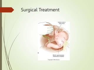 Surgical Treatment
 
