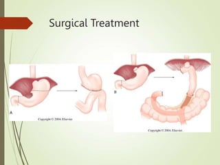 Surgical Treatment
 