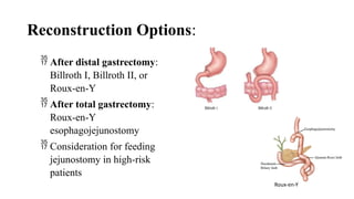 GASTRIC CARCINOMA EVIDENCE BASED MANAGEMENT | PPTX