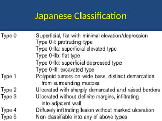 Comprehensive Overview of Gastric Cancer: Diagnosis, Staging, and ...