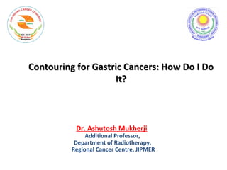 Contouring for Gastric Cancers: How Do I DoContouring for Gastric Cancers: How Do I Do
It?It?
Dr. Ashutosh Mukherji
Additional Professor,
Department of Radiotherapy,
Regional Cancer Centre, JIPMER
 