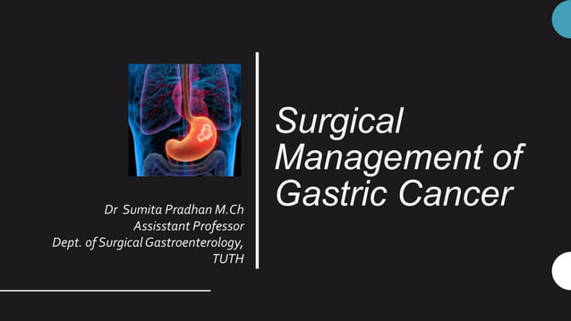 surgical management of gastric cancer | PPTX | Digestive Disorders ...