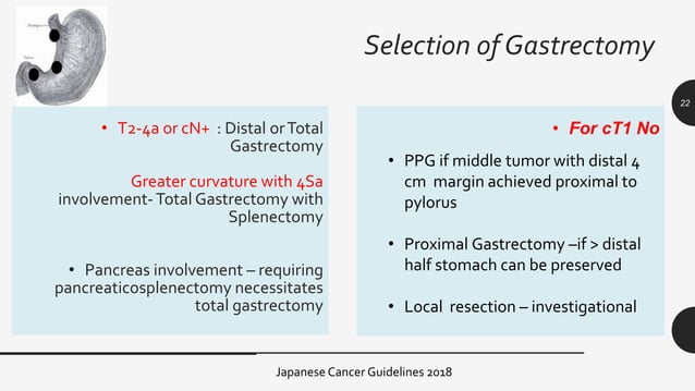 surgical management of gastric cancer | PPTX | Digestive Disorders ...