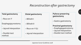 surgical management of gastric cancer | PPTX