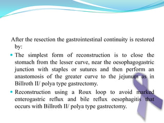 It may show thickened or enlarged gastric folds, filling defects, mass or ulcer.Barim study of upper gastrointestinal study shows a superficial ulcer in the gastric antrum (arrow) with thickened folds radiating towards the ulcer