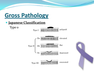 May be flat or polypoid
