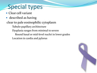 Three distinct patterns have been descriped