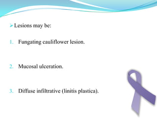 Gross PathologyJapanese Classification