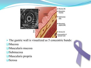   Special types Clear cell variant described as havingclear to pale eosinophilic cytoplasm Tubulo-papillary architectureDysplasia ranges from minimal to severe Round basal or mid-level nuclei in lower gradesLocation in cardia and pylorus
