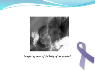 Signs and symptomsAmr Mohamed Halawa738