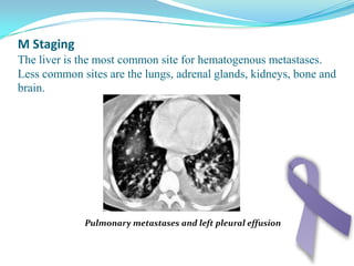 Disturbance of appetite:Anorexia specially to protein meals also anorexia due to other diseases like gastritis ,TB , Anaemia , psychogenic .
