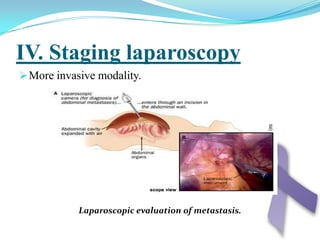 Others:Heart burn , waterbrash ( water and mucus in mouth) and erucation (acidic gastric contents in mouth)