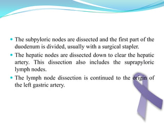 Endoscopic view of an ulcerating adenocarcinoma