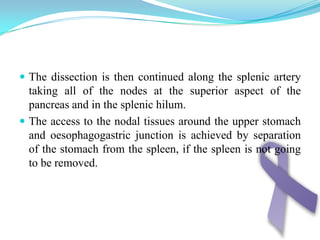 III. Endoscopic ultrasonography (EUS)EUS helps to determine the depth of tumor invasion.