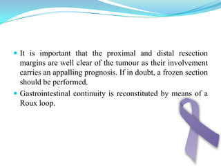 Has the ability to detect sarcomas and other tumors arising from the submucosa and the musculosa (GIST).The gastric wall is visualized as 5 concentric bands: