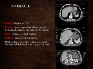 STOMACH:
• Cardia : begins at GEJ
• Fundus : most cephalad, abuts the left
hemidiaphragm,left & superior to cardia.
• Body: central, largest portion.
• Antrum: gateway into pylorus.
• Oral contrast or water is recommended
for optimal delineation of the gastric wall.
 