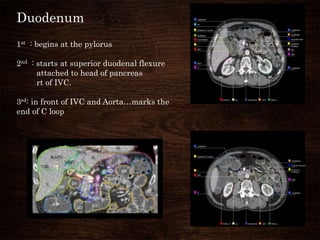 Duodenum
1st : begins at the pylorus
2nd : starts at superior duodenal flexure
attached to head of pancreas
rt of IVC.
3rd: in front of IVC and Aorta…marks the
end of C loop
 