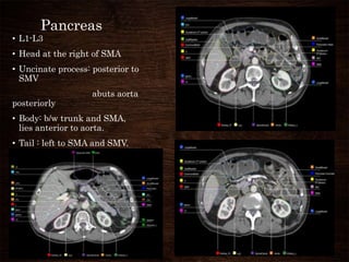 Pancreas
• L1-L3
• Head at the right of SMA
• Uncinate process: posterior to
SMV
abuts aorta
posteriorly
• Body: b/w trunk and SMA,
lies anterior to aorta.
• Tail : left to SMA and SMV.
 