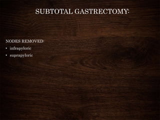 SUBTOTAL GASTRECTOMY:
NODES REMOVED:
• infrapyloric
• suprapyloric
 