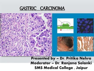 GASTRIC CARCINOMA
Presented by – Dr. Pritika Nehra
Moderator – Dr. Ranjana Solanki
SMS Medical College , Jaipur
 