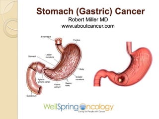 Stomach (Gastric) Cancer
Robert Miller MD
www.aboutcancer.com
 