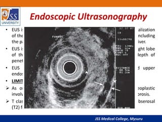Gastric carcinoma radiology ppt | PPTX