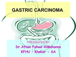 GASTRIC CARCINOMA  PRESENTED BY: Dr.Afnan Fahad AlMuhanna KFHU – Khobar - SA 