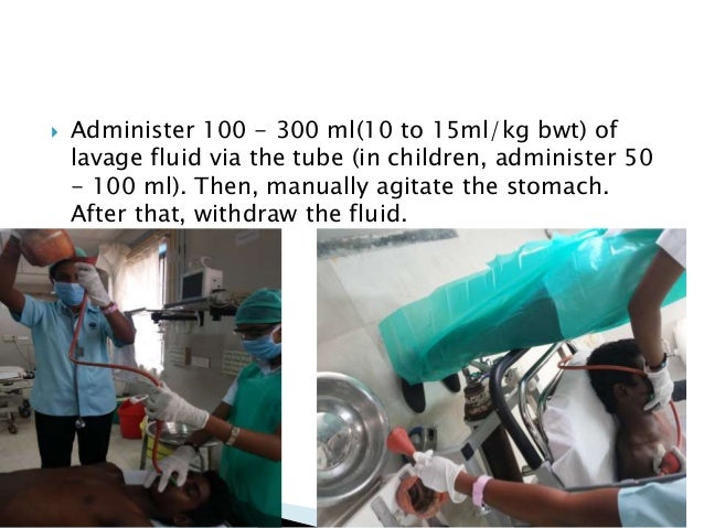 gastric decontamination lavage