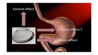 Gastric Disorders Part 1.Hhhhhhhhhtfeefeff