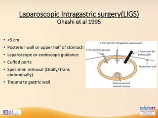 Laparoscopic Intragastric surgery(LIGS)
Ohashi et al 1995
• <5 cm
• Posterior wall or upper half of stomach
• Laparoscope or endoscope guidance
• Cuffed ports
• Specimen removal (Orally/Trans
abdominally)
• Trauma to gastric wall
 