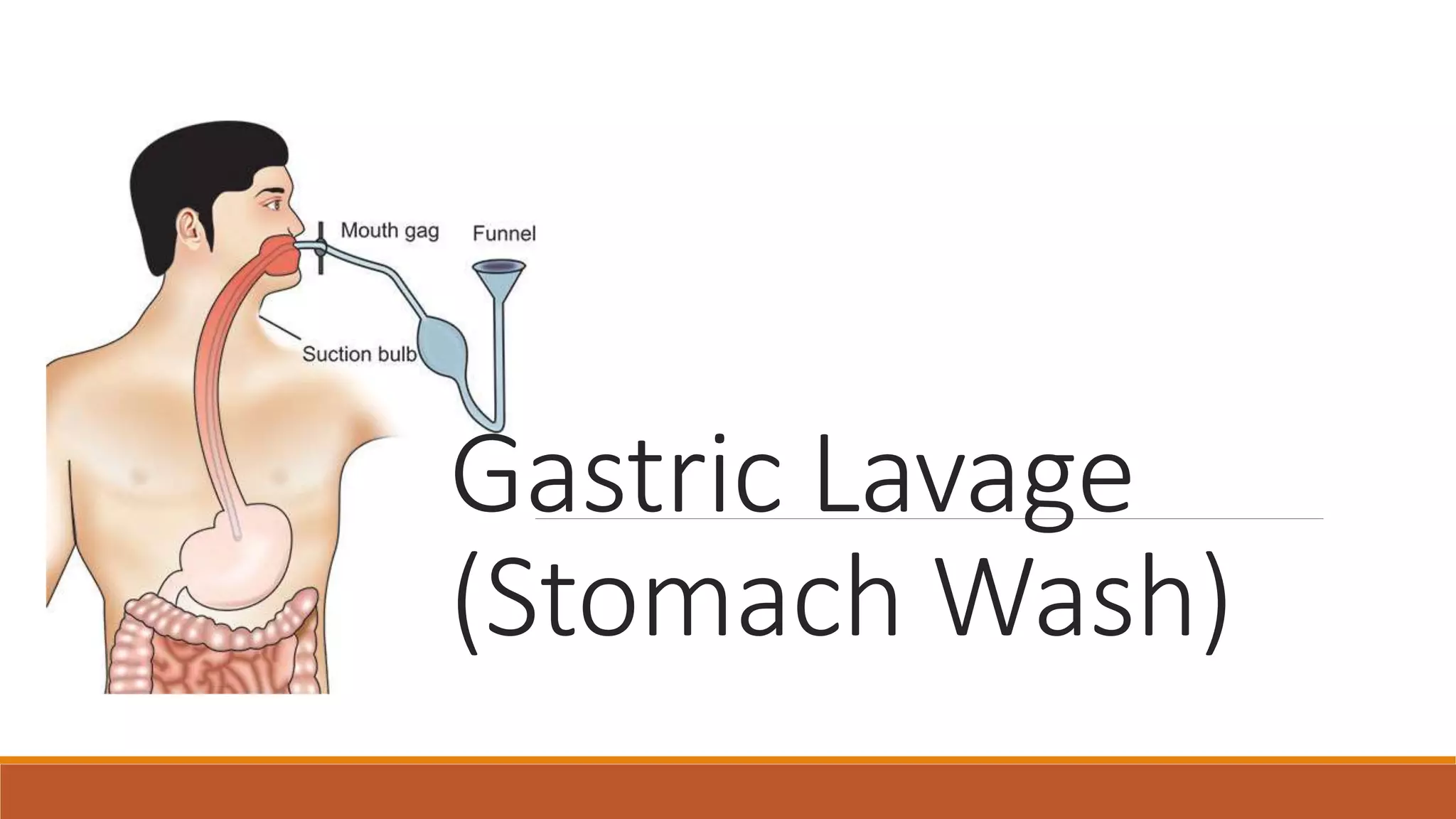 https://image.slidesharecdn.com/gastriclavage-210531163920/75/Gastric-lavage-1-2048.jpg