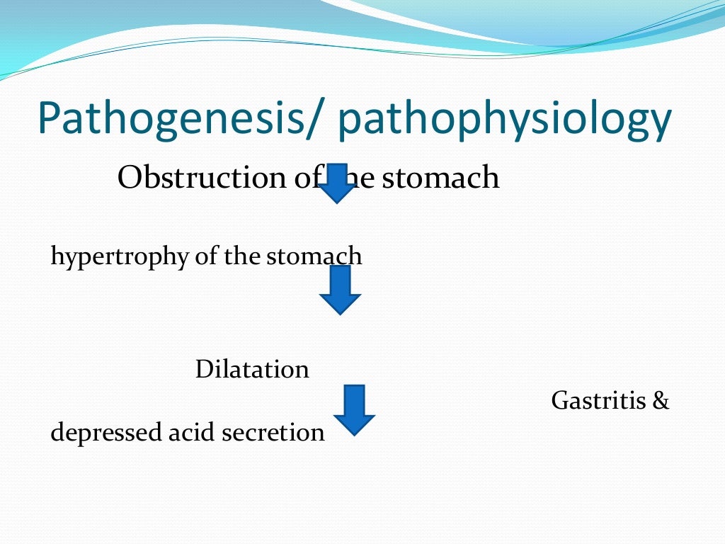 gastric-outlet-obstruction