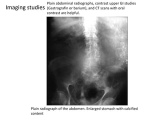 Imaging studies 
Plain abdominal radiographs, contrast upper GI studies 
(Gastrografin or barium), and CT scans with oral 
contrast are helpful. 
Plain radiograph of the abdomen. Enlarged stomach with calcified 
content 
 