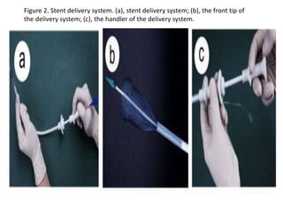 Figure 2. Stent delivery system. (a), stent delivery system; (b), the front tip of 
the delivery system; (c), the handler of the delivery system. 
 