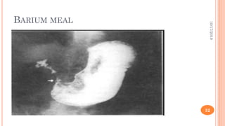BARIUM MEAL
10/17/2019
32
 