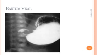 BARIUM MEAL
10/17/2019
33
 