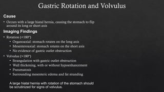 Stomach Rotation Radiology gastric pathology and how they present radiologically | PPTX