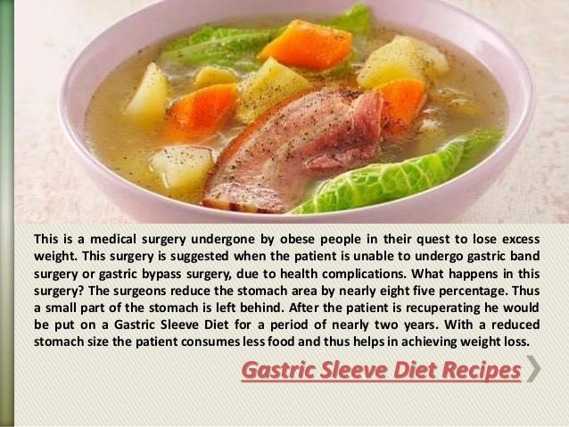 gastric sleeve diet