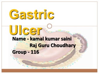Gastric
Ulcer
Name - kamal kumar saini
Raj Guru Choudhary
Group - 116
 