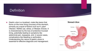 Gastric Ulcer by Wakib Amin.pptx
