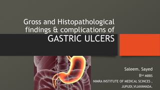 Gross and Histopathological
findings & complications of
GASTRIC ULCERS
Saleem. Sayed
IInd MBBS
NIMRA INSTITUTE OF MEDICAL SCINCES ,
JUPUDI,VIJAYAWADA.
 