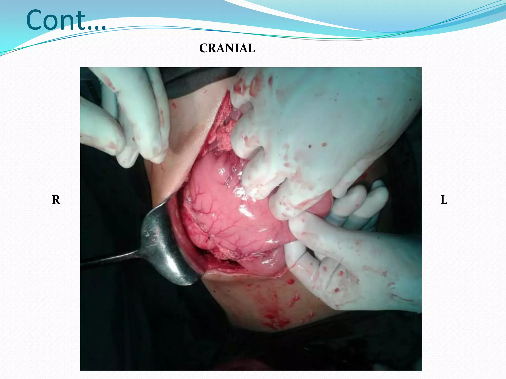 Cont…
CRANIAL

R

L

 