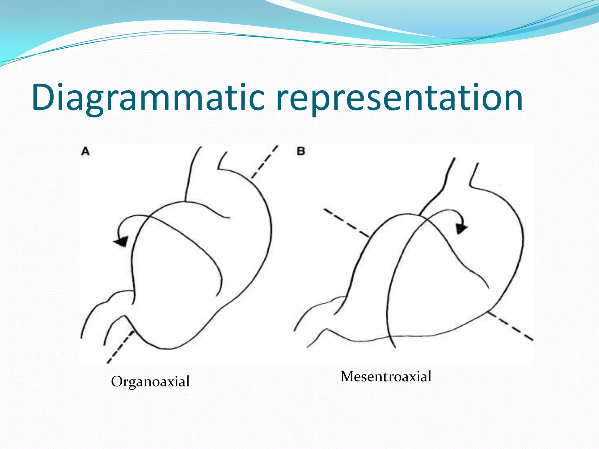 Diagrammatic representation

Organoaxial

Mesentroaxial

 
