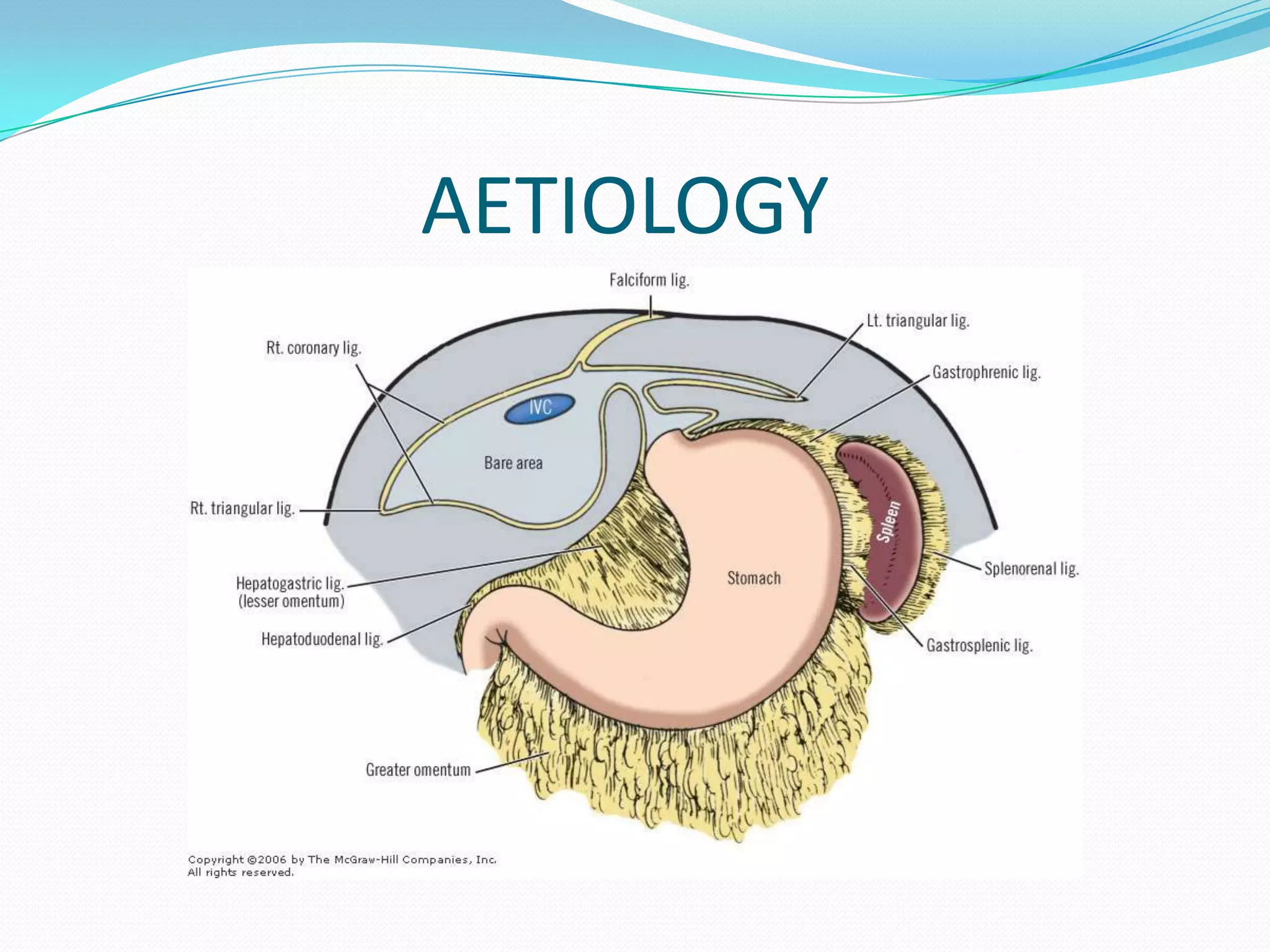 AETIOLOGY

 