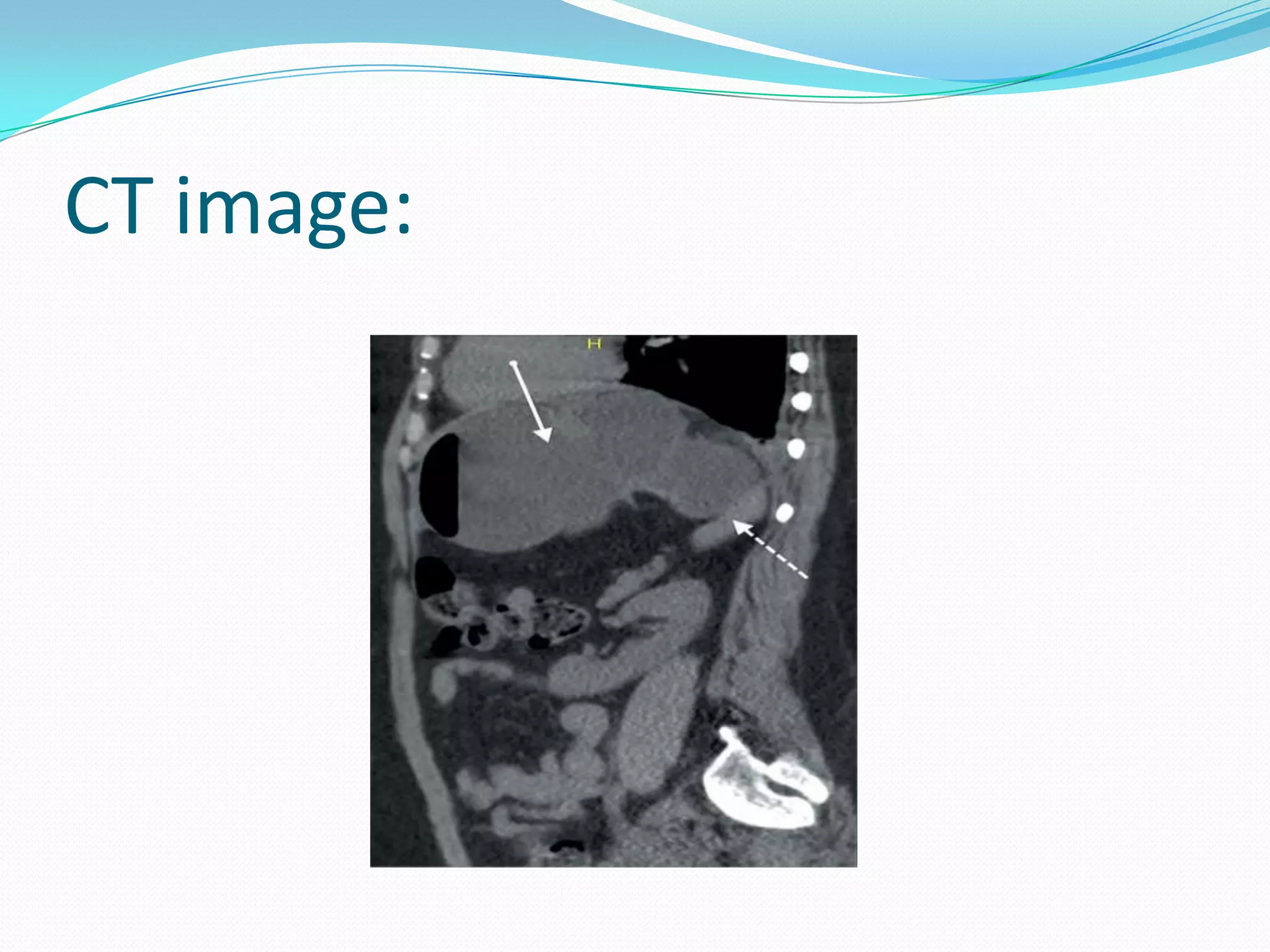 CT image:

 