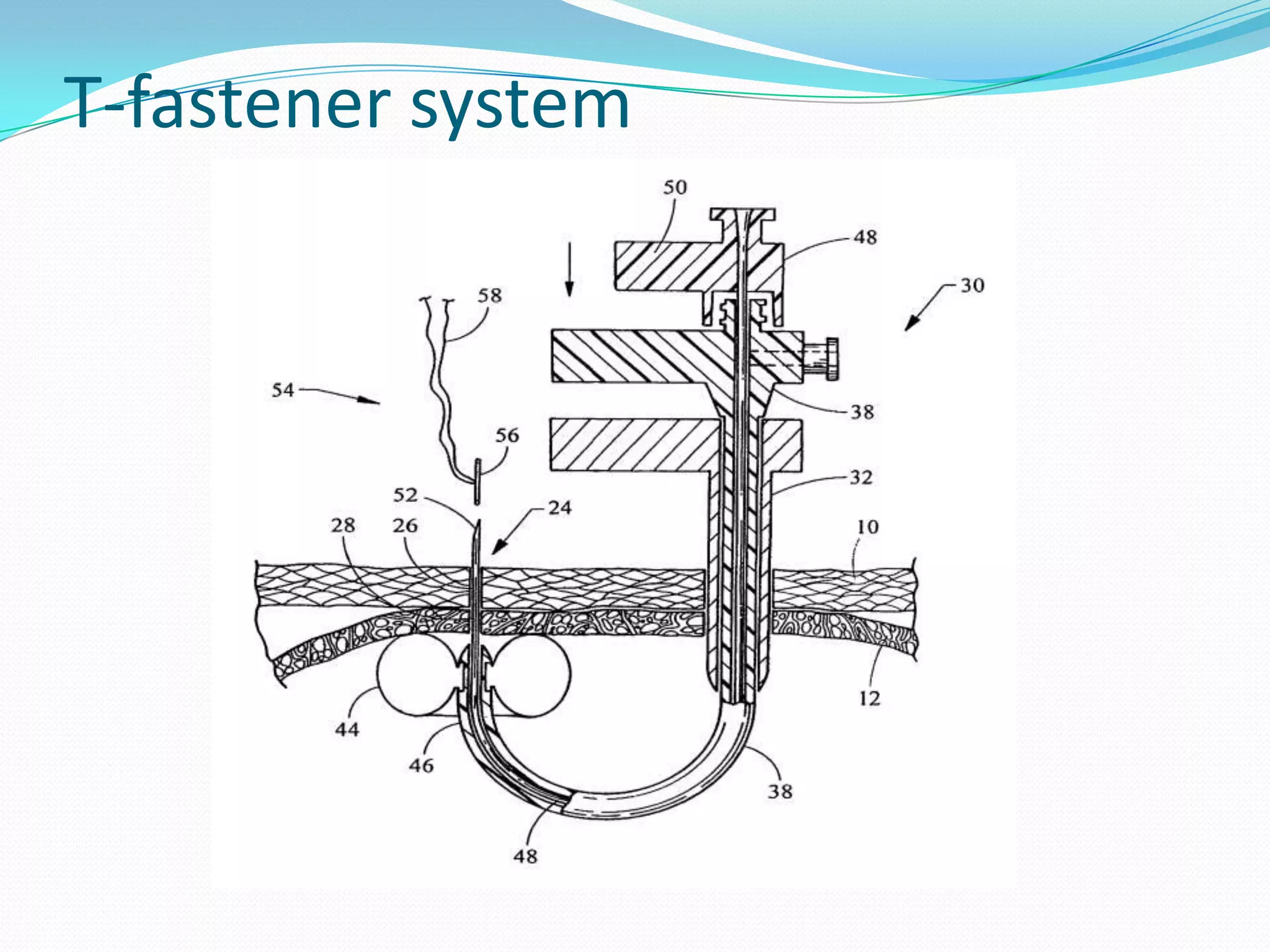T-fastener system

 