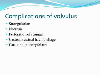 Gastric volvulus and other types of volvulus | PPTX