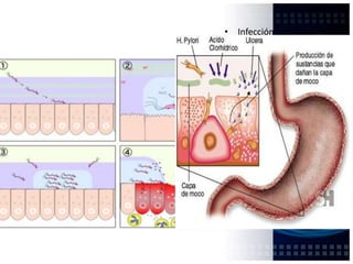 Favorecer la liberación de pepsinógenoCrecimiento de la mucosa