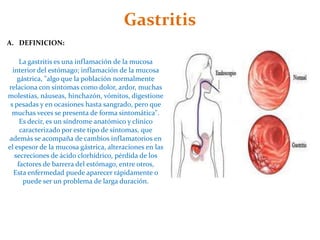 Gastritis
A. DEFINICION:

     La gastritis es una inflamación de la mucosa
  interior del estómago; inflamación de la mucosa
    gástrica, "algo que la población normalmente
relaciona con síntomas como dolor, ardor, muchas
molestias, náuseas, hinchazón, vómitos, digestione
 s pesadas y en ocasiones hasta sangrado, pero que
  muchas veces se presenta de forma sintomática".
     Es decir, es un síndrome anatómico y clínico
     caracterizado por este tipo de síntomas, que
además se acompaña de cambios inflamatorios en
el espesor de la mucosa gástrica, alteraciones en las
   secreciones de ácido clorhídrico, pérdida de los
    factores de barrera del estómago, entre otros,
  Esta enfermedad puede aparecer rápidamente o
      puede ser un problema de larga duración.
 