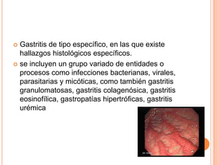  Gastritis de tipo específico, en las que existe
  hallazgos histológicos específicos.
 se incluyen un grupo variado de entidades o
  procesos como infecciones bacterianas, virales,
  parasitarias y micóticas, como también gastritis
  granulomatosas, gastritis colagenósica, gastritis
  eosinofílica, gastropatías hipertróficas, gastritis
  urémica
 